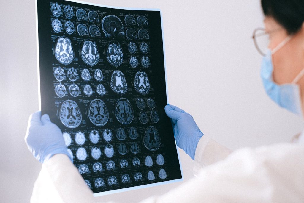 atrophie cortico sous corticale
